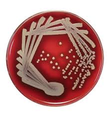 On blood agar plates, colonies of staphylococcus aureus are frequently surrounded by clear zone of hemolysis i.e. Staphylococcus Aureus S Aureus Aladdin Creations