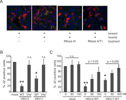 Hunter holden will provide existing holden customers aftersales support for at least 10 years, including warranty, service, spare parts and any required recall or field actions. The Herpes Simplex Virus Host Shutoff Vhs Rnase Limits Accumulation Of Double Stranded Rna In Infected Cells Evidence For Accelerated Decay Of Duplex Rna
