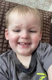 How do I stop my 6 year old grandson from hitting himself in the head  during a melt down. It breaks my heart