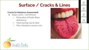 art of ayurveda tongue diagnosis 5 of 9 tongue surface cracks spots bumps