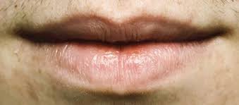 Mole Upper Lip Male Google Search Lips Lip Liner Bottom Lip