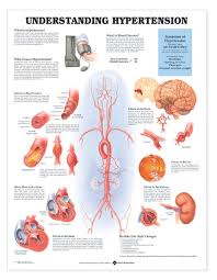 Understanding Hypertension Laminated Anatomical Chart 1st Edition