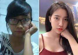 Operasi Plastik Diam Diam Perempuan Ini Tak Dikenali Keluarga Dunia Tempo Co