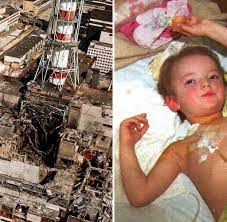 Vom leben mit der katastrophe. Radioaktiver Super Gau Tschernobyl Bis Zu 125 000 Liquidatoren Tot Welt