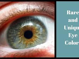 Definitely the different combinations that can occur in patients with the waardenburg syndrome. 6 Rare And Unique Eye Colors Owlcation