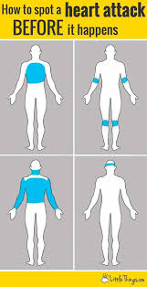 How A Woman Can Spot A Heart Attack Before It Happens In 2020 Heart Attack Health Problems Heart Attack Symptoms