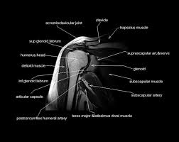 Image result for Shoulder MRI
