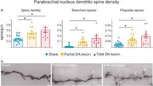 Image result for Paraknoxia