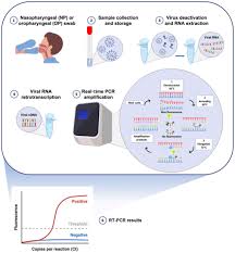 Check spelling or type a new query. Current And Innovative Methods For The Diagnosis Of Covid 19 Infection Review