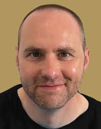 Your Journey to Fuller Hair with Dr. Ted Hair Transplants