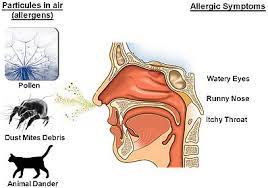 Allergic Rhinitis Natural Treatment And Causes