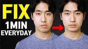 Fix Asymmetrical Face Tmj Dislocation Now Youtube
