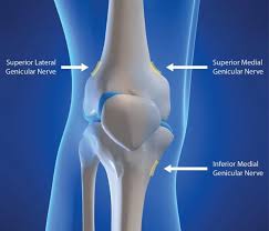 Image result for Radiofrequency Surgery