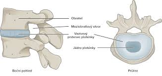 Image result for vyhřezlá ploténka