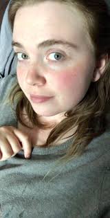 Unexpected skin from normal bag?