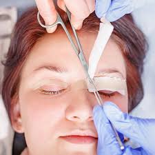 Blefaroplastia en Panamá para corregir los párpados caídos