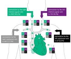 There is an abundance of literature describing best practice, complications, and treatment of venous air embolism associated with central line catheter use. Misplacement And Malposition Of Central Venous Catheters