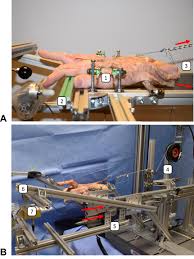 Image result for Elson Extensor Tendon Test