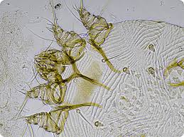 Image result for scabies norvegica