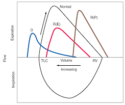 Image result for Functional Residual Capacity