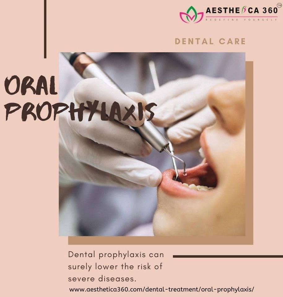 Dental Cleaning & Polishing product image