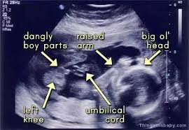 Free pregnancy testing and ultrasounds help determine viability and dates (prenatal medical care and abortions not provided). When Did Hospitals Doctors First Start Being Able To Predict A Baby S Gender Using Ultrasounds Or Other Techniques Quora