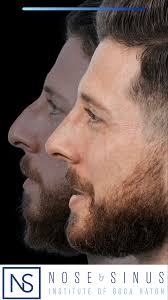 Dr. Melyssa Hancock: Rhinoplasty & Facial Surgery Expert