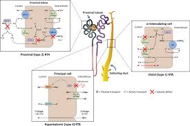 Atomizers can be divided into three main categories disposable atomizers, replaceable coil head atomizers and rebuildable atomizers (rba). Renal Tubular Acidosis And Management Strategies A Narrative Review Springerlink