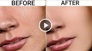 Avoid fried foods, carbonated sugary beverages, and sugar in general to have a glowing, smooth complexion. Get Rid Of Uneven Skin Texture For Smooth Glowing Skin K4 Feed