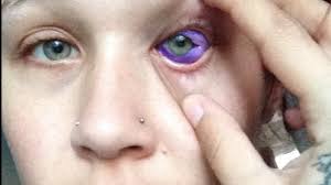 Distress and sadness ( with a tear), doubt and impatience, happiness, straightforwardness and expectation ( clear. Model Goes Blind After Tattooing Eyeball Warns Others Of Dangers