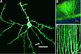 Die genkanone ist ein gerät, mit dessen hilfe man eine genübertragung durchführen kann. Regioselective Biolistic Targeting In Organotypic Brain Slices Using A Modified Gene Gun Protocol Translated To German