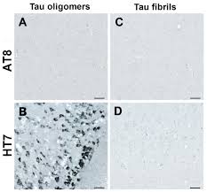 Image result for Silver Grey 1997 AAV