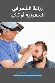 زراعة الشعر في السعودية أو تركيا