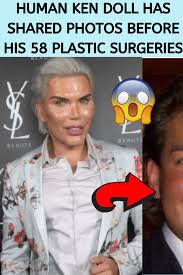 Alves' nose could die and fall off if he continues to have work done. Human Ken Doll Has Shared Photos Before His 58 Plastic Surgeries