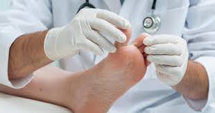Foot numbness, also known as peripheral neuropathy, is a problem that we see very often as foot and ankle specialists. Toe Numbness Numb Toes Symptoms Causes Treatments Diagnosis