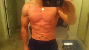 Visceral fat is the unseen fat around your organs, which is often referred to as visceral abdominal fat. Loose Skin The Facts T Nation