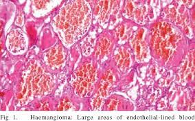 Pdf Cutaneous Haemangioma In A Dog A Case Report Semantic Scholar