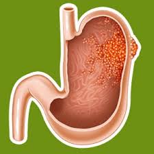 Les symptômes du cancer de l'estomac apparaissent tardivement. Tumeur De L Estomac Chez Le Chien Conseil Veto Illustre Catedog