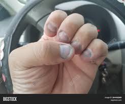 Short Bitten Dirty Image Photo Free Trial Bigstock My boyfriend has always bitten his nails.