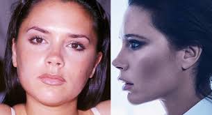 Cum arăta Victoria Beckham înainte să meargă pe mâna chirurgilor  plasticieni