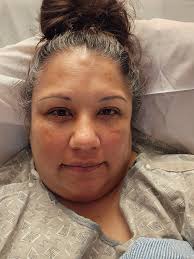 Starting new life after gastric bypass surgery