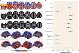 The following are the most common symptoms of adhd. Multimodal Structural Neuroimaging Markers Of Brain Development And Adhd Symptoms American Journal Of Psychiatry