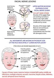Instant Anatomy Head And Neck Areas Organs Face Facial Nerve Lesions Facial Nerve Medical Knowledge Brain Anatomy