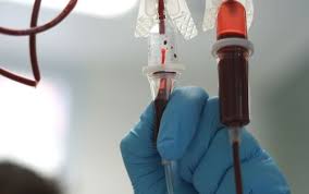 Image result for Plasma Transfusion