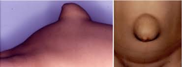 Image result for Umbilicus botryoides