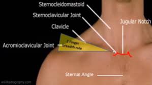 Nicola mclaren msc • reviewer: Sternoclavicular Joint Disorders Physiopedia