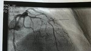 Fundraiser by Aimee Pepper : Help Mom Recover & Move Into Her New Home!