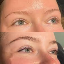 Remedy Facial Bar & Spa