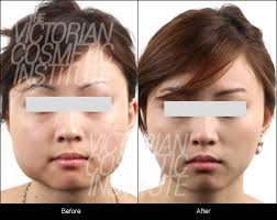 Do jawline exercises actually work? How To Get A Beautiful Jawline Vci