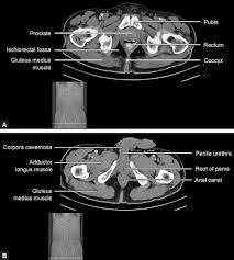 This mri male pelvis axial cross sectional anatomy tool is absolutely free to use. Jaypeedigital Ebook Reader
